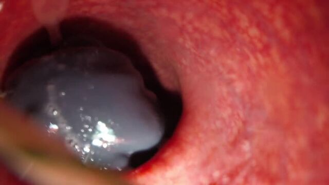 КАМЕРА ВНУТРИ ВАГИНЫ И ЗАДНИЦЫ Порно,секс.анал,инцест,куни,трах,кончает, ебал,скрытая камера